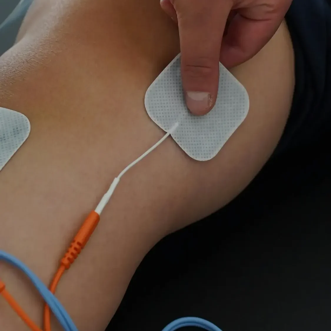 Fisioterapeuta a domicilio en Valencia tratando a paciente con electroestimulador